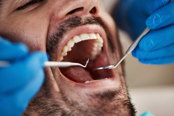 Best Emergency Dentist for Knocked-Out Tooth in Craig Beach, OH